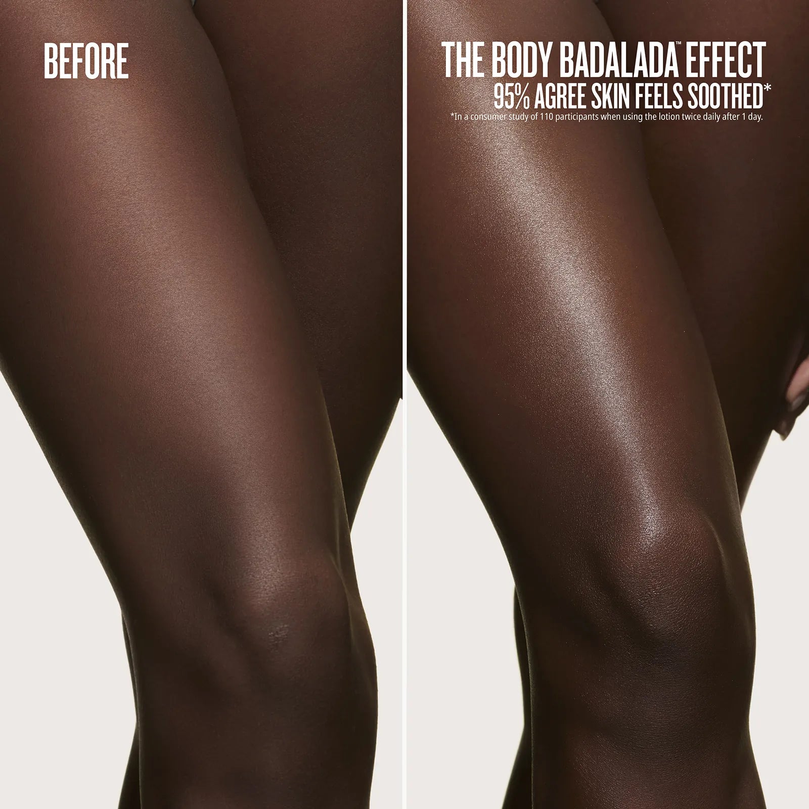 before//after the body badalada effect 95% agree skin feels soothed* *in a consumer study of 110 participants when using the lotion twice daily after 1 day