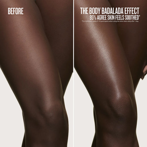 before//after the body badalada effect 95% agree skin feels soothed* *in a consumer study of 110 participants when using the lotion twice daily after 1 day