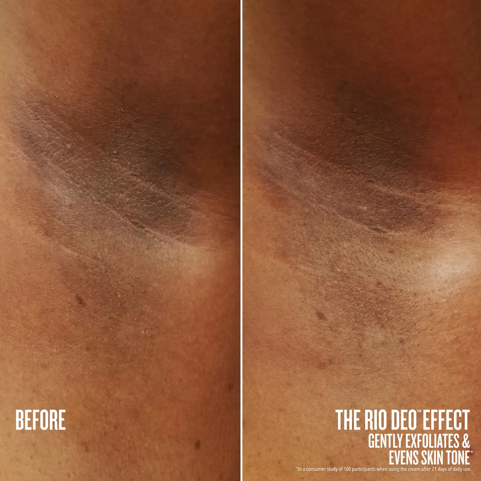 before // after the rio deo effect