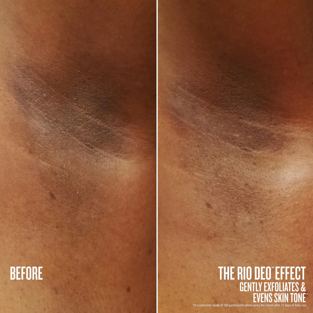 Before and after comparison of skin exfoliation with text indicating product effect.